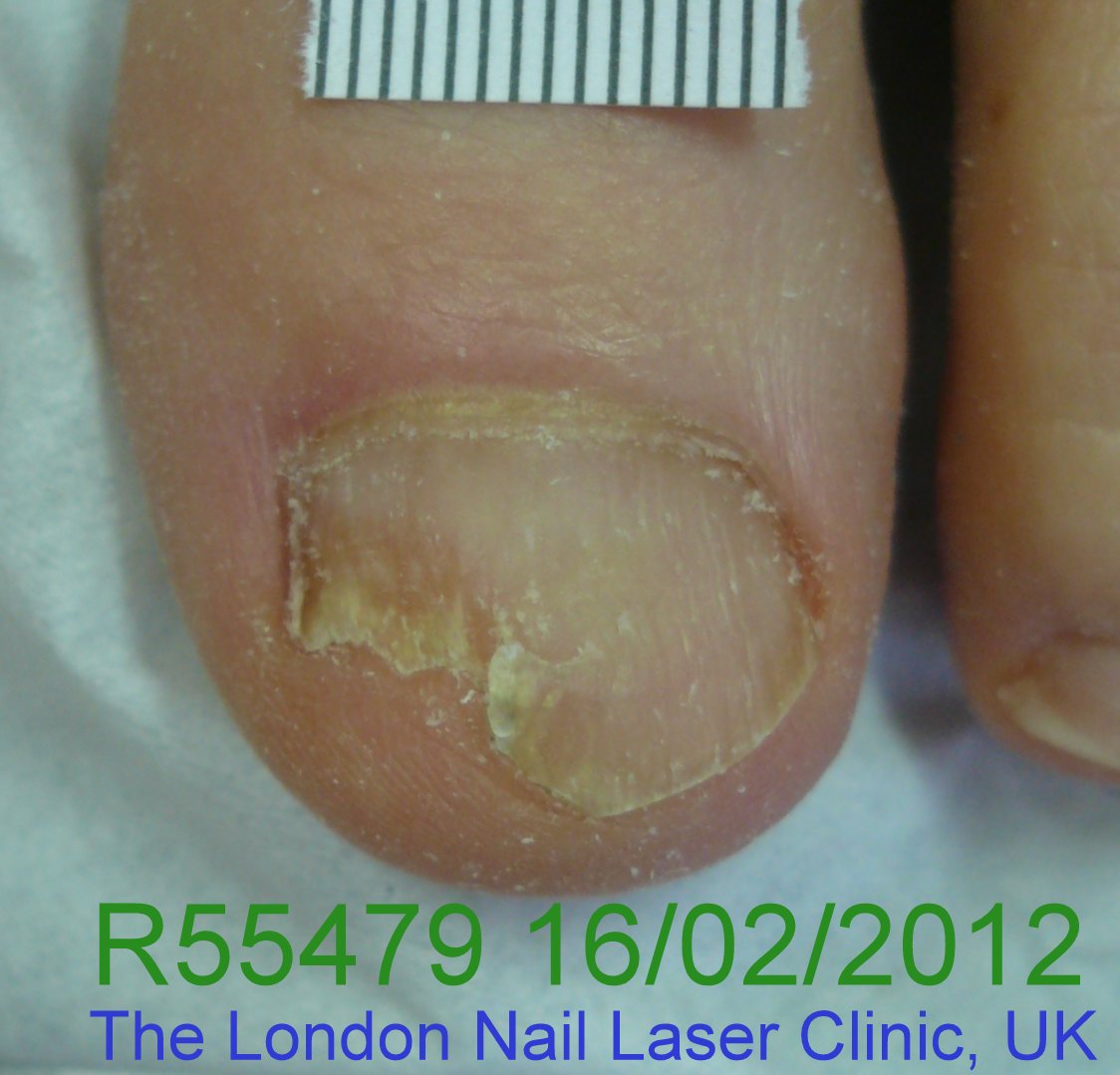 R55479-16-02-12012-2nd